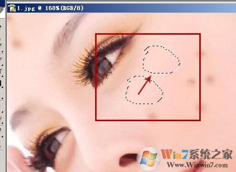 照片的臉上長痘痘怎么調(diào)？教你照片臉上長痘痘怎么去除