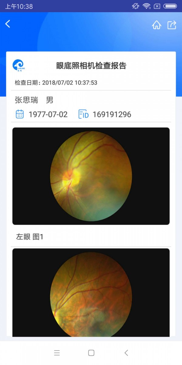 KJ眼底相機